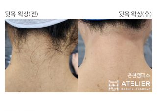 왁싱과정